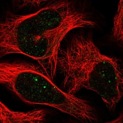 Invitrogen CBX4 Polyclonal Antibody 100 &mu;L; Unconjugated:Antibodies,