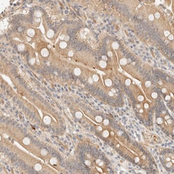 Invitrogen TNK1 Polyclonal Antibody 100 &mu;L | Buy Online | Invitrogen&trade; | Fisher Scientific