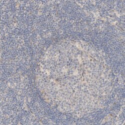 Invitrogen TNK1 Polyclonal Antibody 100 &mu;L | Buy Online | Invitrogen&trade; | Fisher Scientific