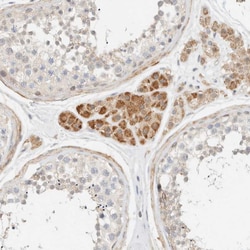 Invitrogen TNK1 Polyclonal Antibody 100 &mu;L | Buy Online | Invitrogen&trade; | Fisher Scientific