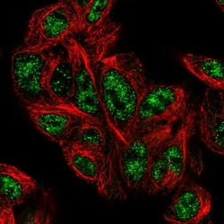 PHYHD1 Polyclonal Antibody:Antibodies, Polyclonal