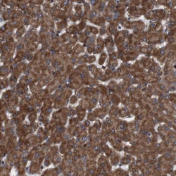 Invitrogen SIGLEC8 Polyclonal Antibody 100 &mu;L; Unconjugated:Antibodies,