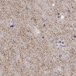 Invitrogen™ Dopamine Transporter Polyclonal Antibody
