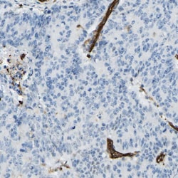 Invitrogen TEM7 Polyclonal Antibody 100 &mu;L; Unconjugated:Antibodies,