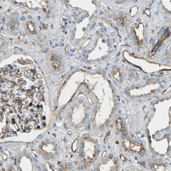 Invitrogen TEM7 Polyclonal Antibody 100 &mu;L; Unconjugated:Antibodies,