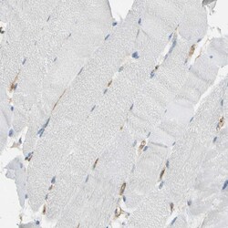 Invitrogen TEM7 Polyclonal Antibody 100 &mu;L; Unconjugated:Antibodies,
