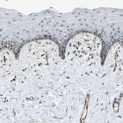Invitrogen ECE1 Polyclonal Antibody 100 &mu;L; Unconjugated:Antibodies,