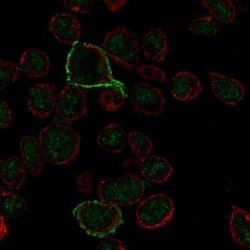 Invitrogen CD20 Polyclonal Antibody 100 μL; Unconjugated:Antibodies,
