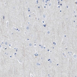 Invitrogen CD20 Polyclonal Antibody 100 μL; Unconjugated:Antibodies,