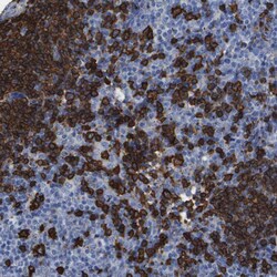 Invitrogen CD20 Polyclonal Antibody 100 μL; Unconjugated:Antibodies,