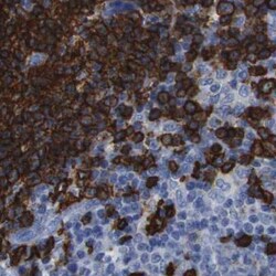 Invitrogen CD20 Polyclonal Antibody 100 μL; Unconjugated:Antibodies,