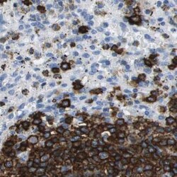 Invitrogen CD20 Polyclonal Antibody 100 μL; Unconjugated:Antibodies,