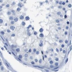 Invitrogen CD20 Polyclonal Antibody 100 μL; Unconjugated:Antibodies,