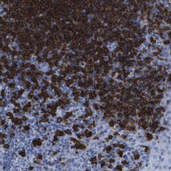Invitrogen CD20 Polyclonal Antibody 100 μL; Unconjugated:Antibodies,