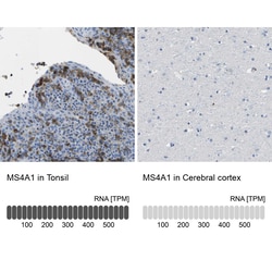 Invitrogen CD20 Polyclonal Antibody 100 μL; Unconjugated:Antibodies,