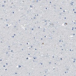 Invitrogen CD20 Polyclonal Antibody 100 μL; Unconjugated:Antibodies,