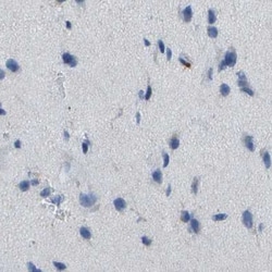 Invitrogen CD20 Polyclonal Antibody 100 μL; Unconjugated:Antibodies,