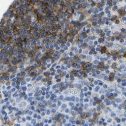 Invitrogen CD20 Polyclonal Antibody 100 μL; Unconjugated:Antibodies,