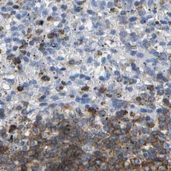 Invitrogen CD20 Polyclonal Antibody 100 μL; Unconjugated:Antibodies,