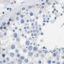 Invitrogen CD20 Polyclonal Antibody 100 μL; Unconjugated:Antibodies,