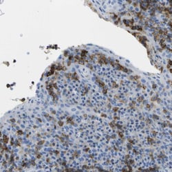 Invitrogen CD20 Polyclonal Antibody 100 μL; Unconjugated:Antibodies,