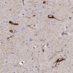 Invitrogen TAC1 Polyclonal Antibody 100 &mu;L; Unconjugated:Antibodies,