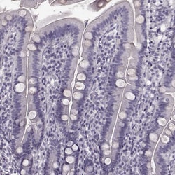 Invitrogen TRPM1 Polyclonal Antibody 100 &mu;L; Unconjugated:Antibodies,