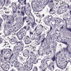 Invitrogen TRPM1 Polyclonal Antibody 100 &mu;L; Unconjugated:Antibodies,