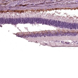 Invitrogen TRPM1 Polyclonal Antibody 100 &mu;L; Unconjugated:Antibodies,