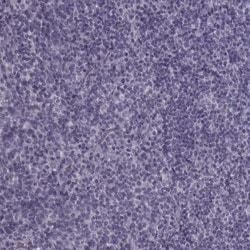 Invitrogen TRPM1 Polyclonal Antibody 100 &mu;L; Unconjugated:Antibodies,