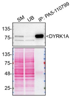 Invitrogen DYRK1A Polyclonal Antibody 100 μL; Unconjugated:Antibodies,