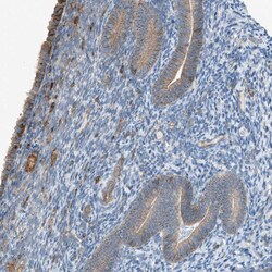 Invitrogen DYRK1A Polyclonal Antibody 100 μL; Unconjugated:Antibodies,