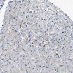 Invitrogen DYRK1A Polyclonal Antibody 100 μL; Unconjugated:Antibodies,