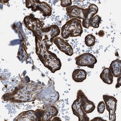 Invitrogen DYRK1A Polyclonal Antibody 100 μL; Unconjugated:Antibodies,
