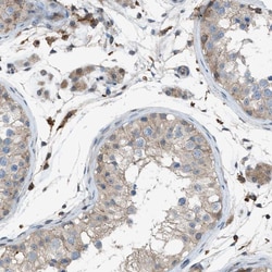 Invitrogen DYRK1A Polyclonal Antibody 100 μL; Unconjugated:Antibodies,