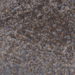 Invitrogen GRK6 Polyclonal Antibody 100 &mu;L; Unconjugated:Antibodies,
