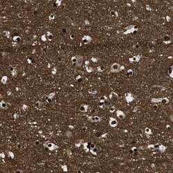 Invitrogen GAP43 Polyclonal Antibody 100 μL; Unconjugated:Antibodies,