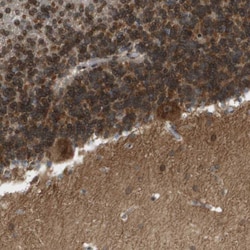 Invitrogen™ Calcium Channel beta-4 Polyclonal Antibody