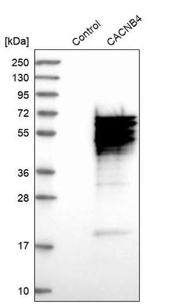 Calcium Channel beta-4 Polyclonal Antibody, Invitrogen 100 &mu;L; Unconjugated:Antibodies,