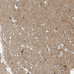 Invitrogen CD100 Polyclonal Antibody 100 &mu;L; Unconjugated:Antibodies,