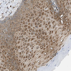 Invitrogen CD100 Polyclonal Antibody 100 &mu;L; Unconjugated:Antibodies,