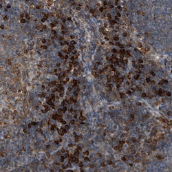 Invitrogen CD100 Polyclonal Antibody 100 &mu;L; Unconjugated:Antibodies,