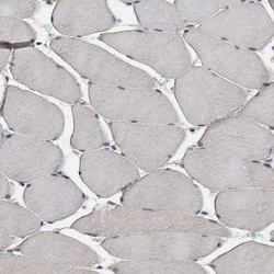 Invitrogen PKD2 Polyclonal Antibody 100 &mu;L | Buy Online | Invitrogen&trade; | Fisher Scientific