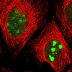 Invitrogen DEPDC7 Polyclonal Antibody 100 &mu;L; Unconjugated:Antibodies,