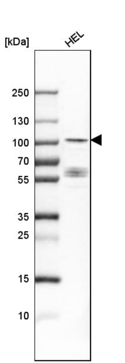 Invitrogen DYRK1A Polyclonal Antibody 100 &mu;L; Unconjugated:Anticuerpos