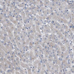 Invitrogen HSPB8 Polyclonal Antibody 100 &mu;L; Unconjugated:Antibodies,