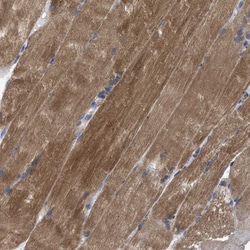 Invitrogen HSPB8 Polyclonal Antibody 100 &mu;L; Unconjugated:Antibodies,