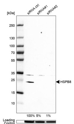 Invitrogen HSPB8 Polyclonal Antibody 100 &mu;L; Unconjugated:Antibodies,