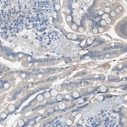 Invitrogen GPR77 Polyclonal Antibody 100 &mu;L; Unconjugated:Antibodies,