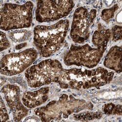 Invitrogen DUSP10 Polyclonal Antibody 100 &mu;L; Unconjugated:Antibodies,